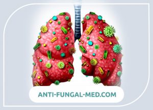 Pneumocystosis (Pneumocystis Pneumonia) – Life Without Infections Blog
